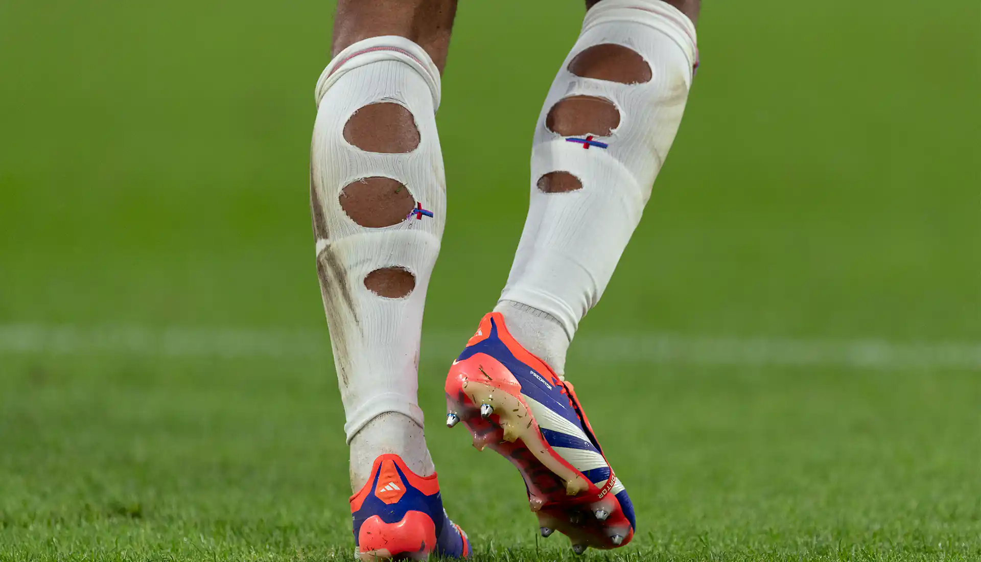 Player comfort: Holey football socks: the performance conversation